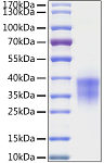 Recombinant Human Granzyme B Protein (RP02860)