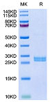 Recombinant Mouse Hepcidin/HAMP Protein (RP02870LQ)