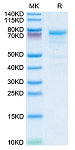 Recombinant Human Plasma Kallikrein/KLKB1 Protein (RP02872)