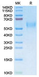 Recombinant Mouse uPAR/PLAUR/CD87 Protein (RP02934LQ)