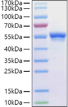 Recombinant Human Glucose-6-phosphate 1-dehydrogenase/G6PD Protein
