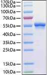 Recombinant Human Glucose-6-phosphate 1-dehydrogenase/G6PD Protein (RP02937LQ)