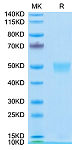 Recombinant Human LRG1 Protein (RP02953)