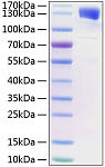 Recombinant Mouse Leptin receptor/LEP-R/CD295 Protein (RP02959)