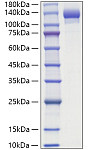 Recombinant Human ENPP-1 Protein (RP02960)