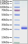 Recombinant Mouse Angiopoietin-like 3/ANGPTL3 Protein (RP02967)