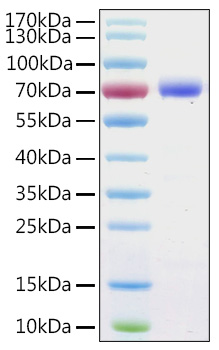 Recombinant Human ANXA6 Protein