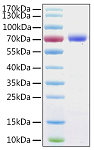 Recombinant Human ANXA6 Protein (RP02985)