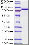 Recombinant Human Ezrin/EZR Protein (RP02986LQ)
