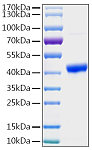 Recombinant Human PGK1 Protein (RP02987LQ)