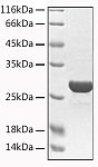 Recombinant Human Granzyme A Protein (RP02990)