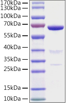 Recombinant Human AMH Protein