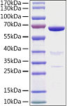 Recombinant Human AMH Protein (RP02999)