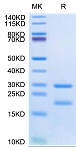 Recombinant Human MASP2 Protein (RP03101LQ)