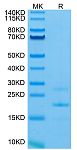 Recombinant Mouse MASP2 Protein (RP03102LQ)
