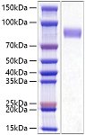 Recombinant Human AKT3 Protein (RP03143)