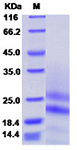 Recombinant Mouse PDGF-AA Protein (RP03145)