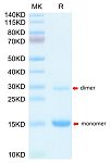 Recombinant Mouse S100A9/MRP14 Protein (RP03159LQ)