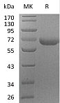 Recombinant Human PRCP Protein (RP03204LQ)