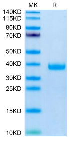 Recombinant Mouse FSTL3 Protein