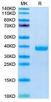 Recombinant Mouse FSTL3 Protein (RP03254)