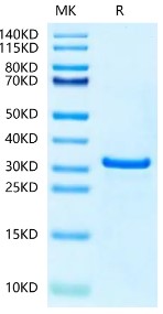 Recombinant Human NUDT5 Protein