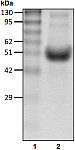 Recombinant Human GP110/ARM-1/ADRM1 protein (RP10002LQ)