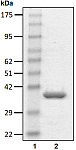 Recombinant Human PA28gamma/PSME3 protein (RP10020LQ)