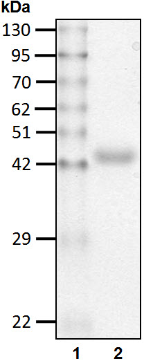 Recombinant Human Ubiquitin thioesterase L1/UCHL1 protein