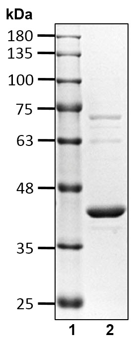 Recombinant Human Ubiquitin carboxyl-terminal hydrolase 21/USP21 protein