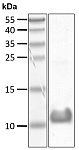 Recombinant Human Ubiquitin(L73P) protein (RP10184LQ)