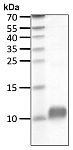 Recombinant Human Ubiquitin(1-75) protein (RP10186LQ)