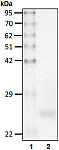 Recombinant Human Ubiquitin thioesterase L1/UCHL1 protein (RP10187LQ)