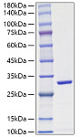Recombinant Schistosoma japonicum GST Protein (RPT0001)