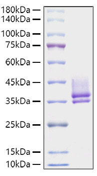 Recombinant Serratia marcescens Nuclease